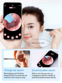 Multifunctional Ear Cleaner Camera 360°Adjustable Endoscope Ear Pick. USB-C Charging Ear Cleaner Family Ear Care Kit for Family