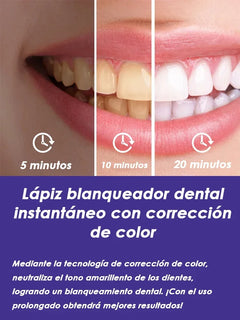 Purple Instant Teeth Whitening Pen Tartar Toothpaste Clean Teeth Stains No Sensitivity for Clearer Brighter Smile Cavity Care bd