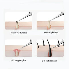 4-11Pcs Ingrown Hair Tweezers Acne Blackhead Removal Needles Black Dots Cleaner Deep Cleansing Pore Cleaner Face Skin Care Tools